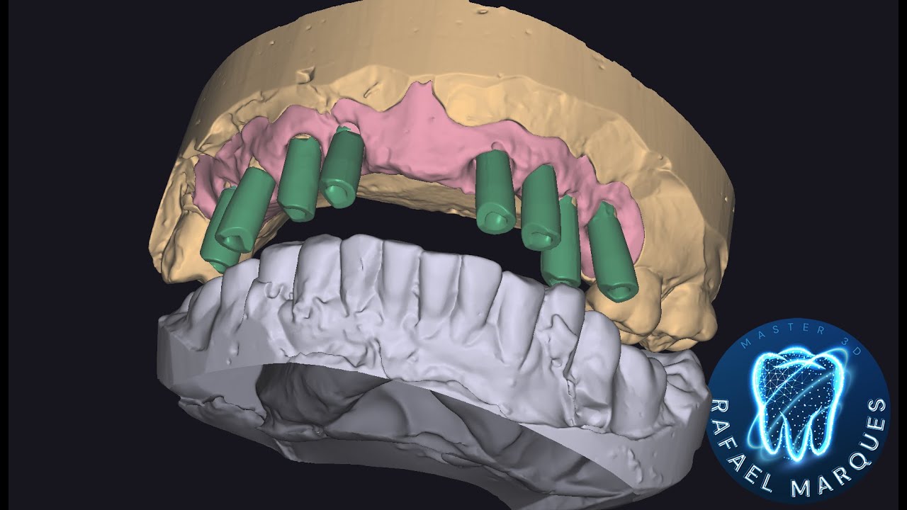 Estrutura Metálica para Protocolo Cerâmico
