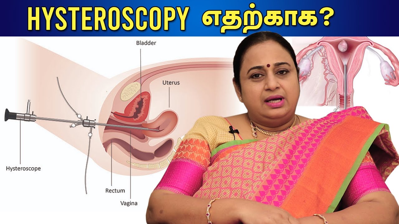 ஹிஸ்ட்ரோஸ்கோப்பி ஏன் செய்ய வேண்டும் | Benefits of Hysteroscopy | Dr G Buvaneswari | GBR
