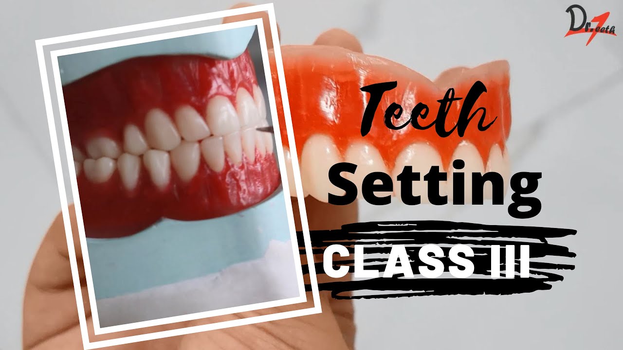 PROSTHODONTICS | Class Three Teeth Arrangement Made Easy