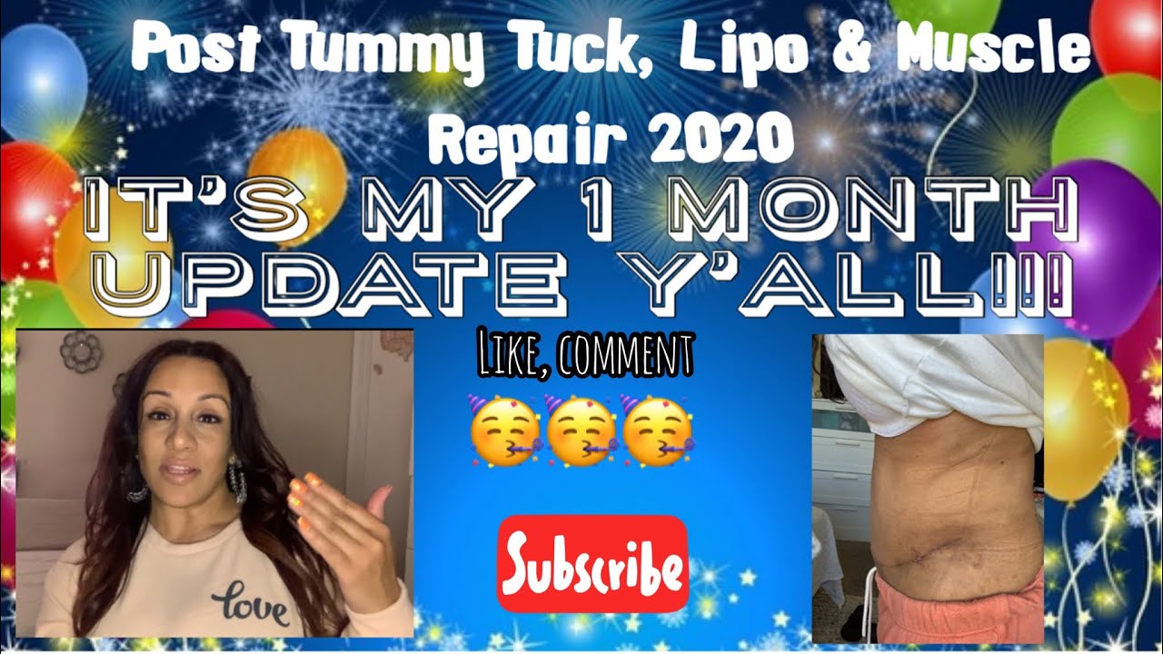 1 month update post Tummy Tuck, Lipo & Muscle Repair 2020!