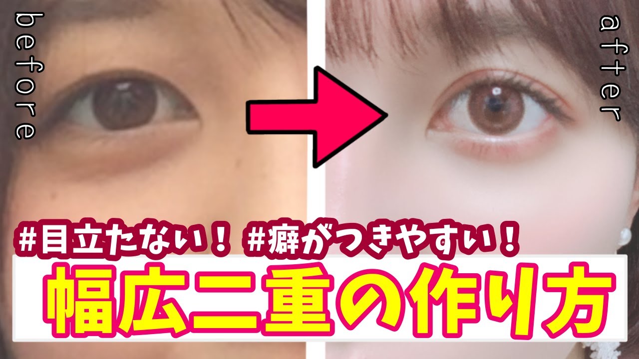 【最強アイテープ】バレずに二重の癖付け！結局どんなアイテープが一番良いの？