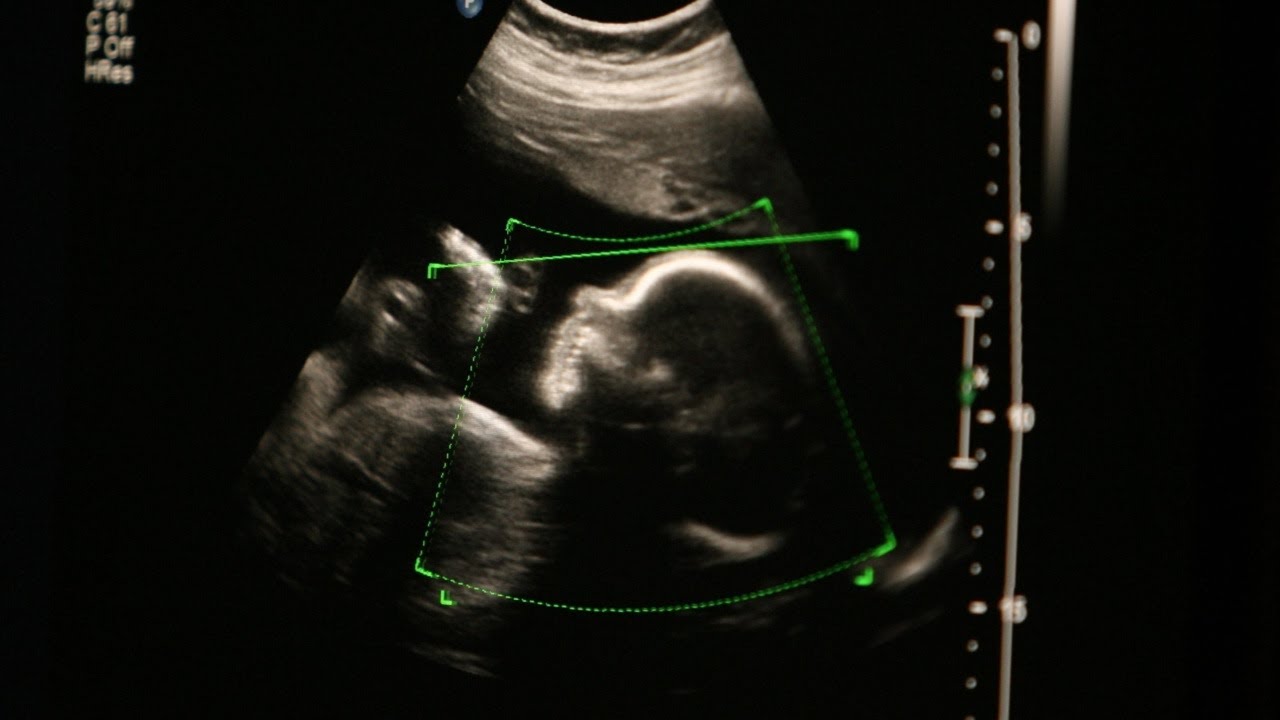 ‘Radical’: Some Democrats discuss abortion ‘even after a baby is born’
