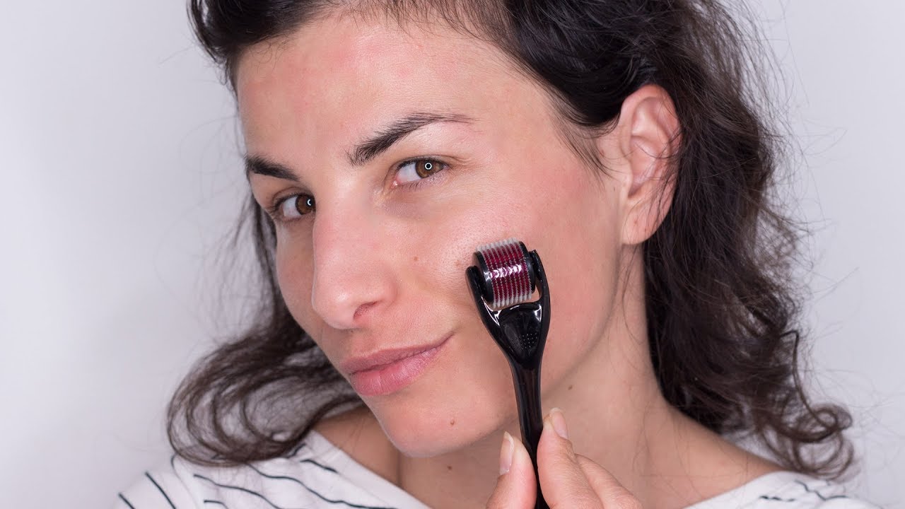 Τι Είναι το MICRO NEEDLING? Θεραπεία στο Σπίτι || Vasiliki Von