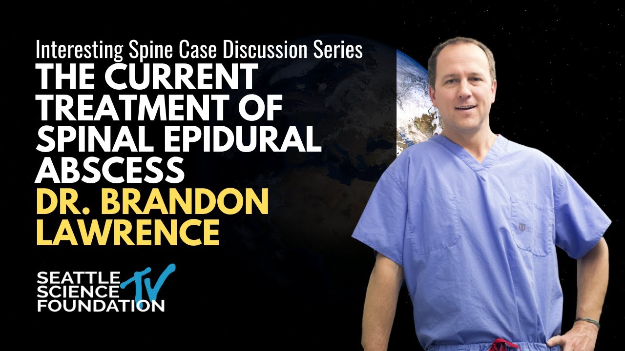 The Current Treatment of Spinal Epidural Abscess - Brandon Lawrence, MD