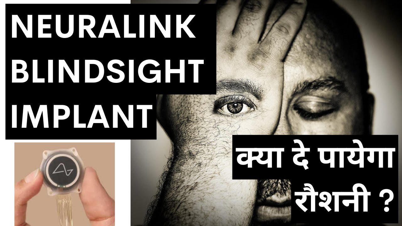 NEURALINK BLINDSIGHT DEVICE !! क्या BLINDNESS ठीक कर पायेगा ?