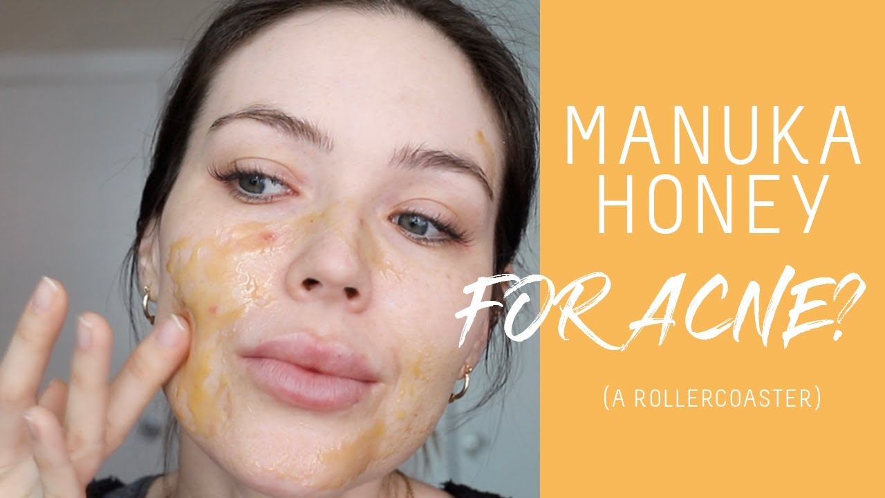 I tried manuka honey for acne + hyperpigmentation | Nicole Masifilo