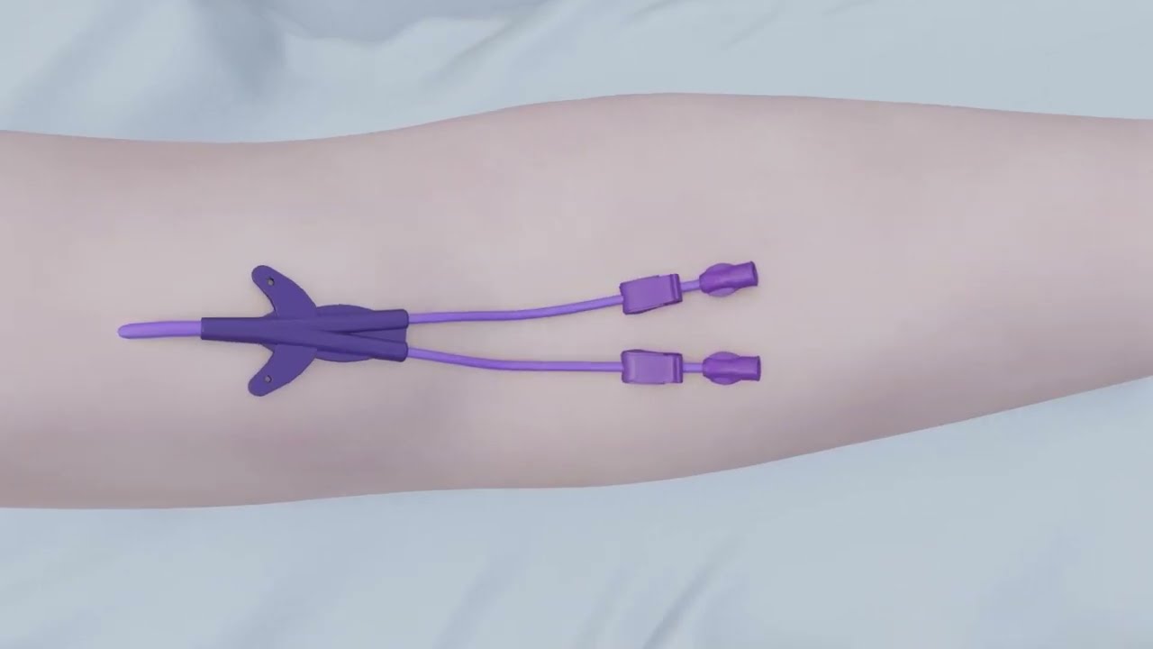 Mise en place d’un PICC Line au CHU : vidéo didactique
