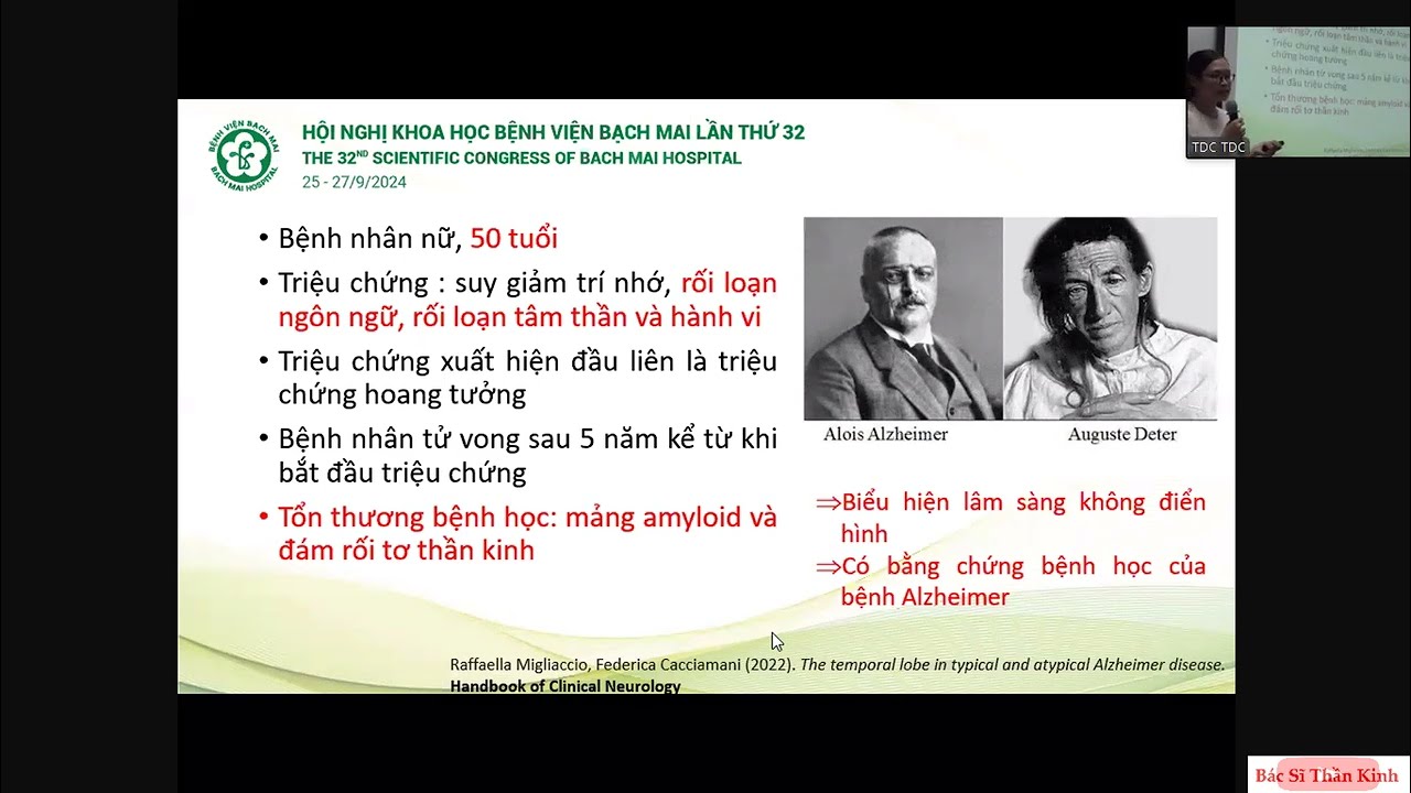 Các thể không điển hình của bệnh ALZHEIMER