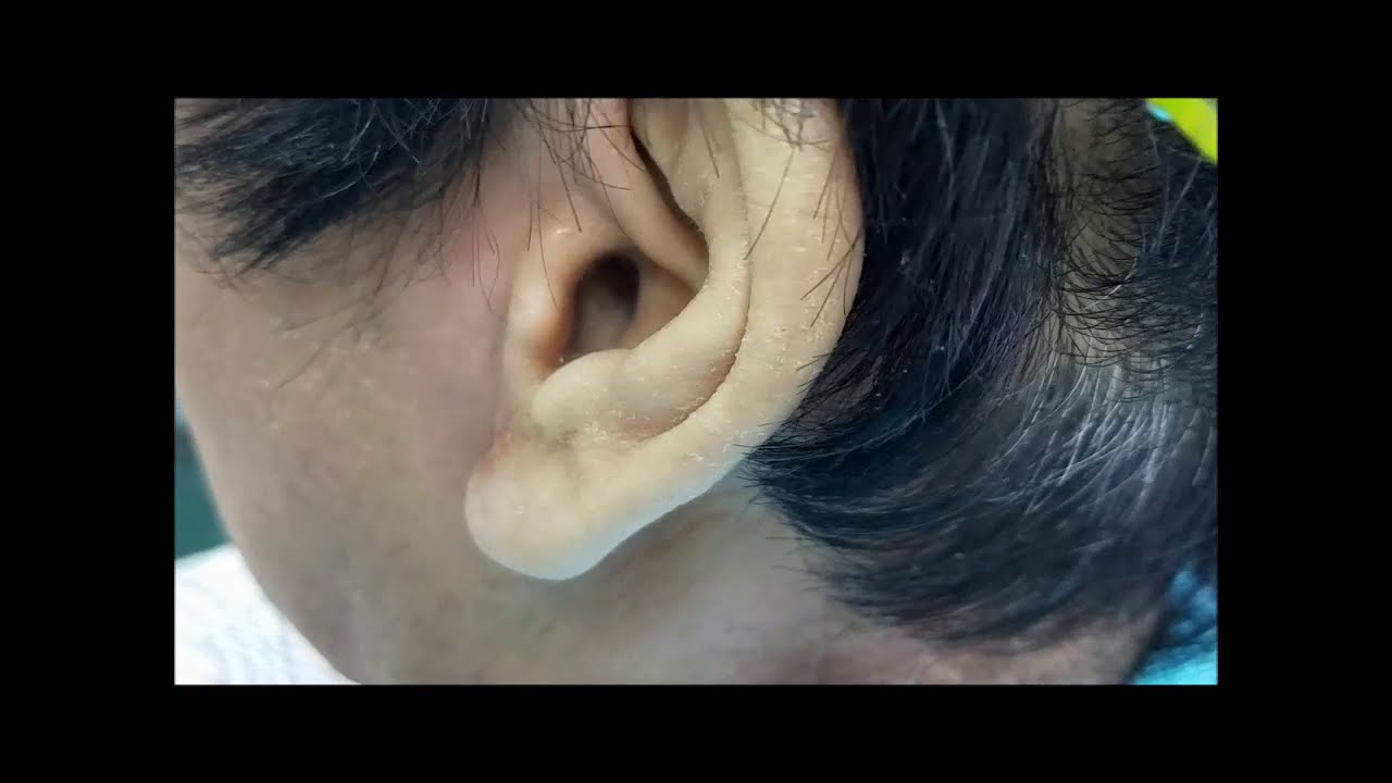 白髪抜き 裾の密集した白髪を抜く白髪抜いた数は？　　Plucking white hair　白发去掉　Không có tóc bạc
