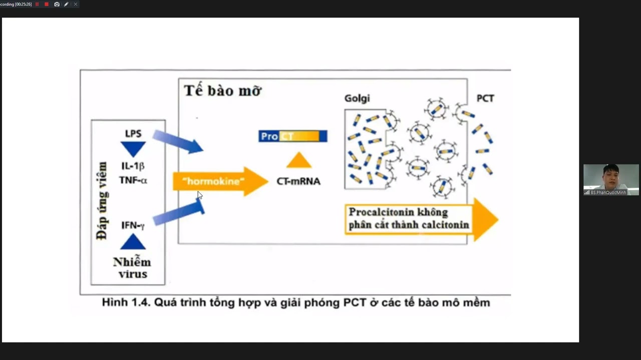Ứng dụng của Procalcitonin và CRP trong lâm sàng