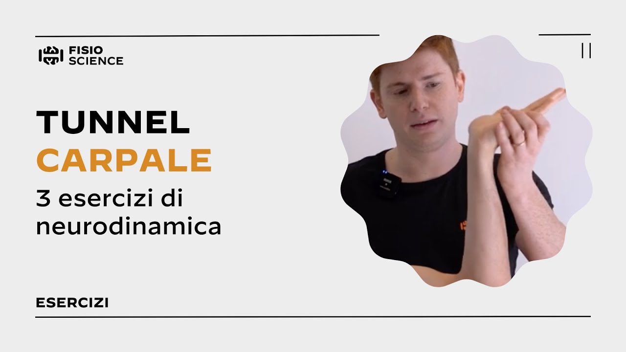 3 Esercizi per la Sindrome del Tunnel Carpale