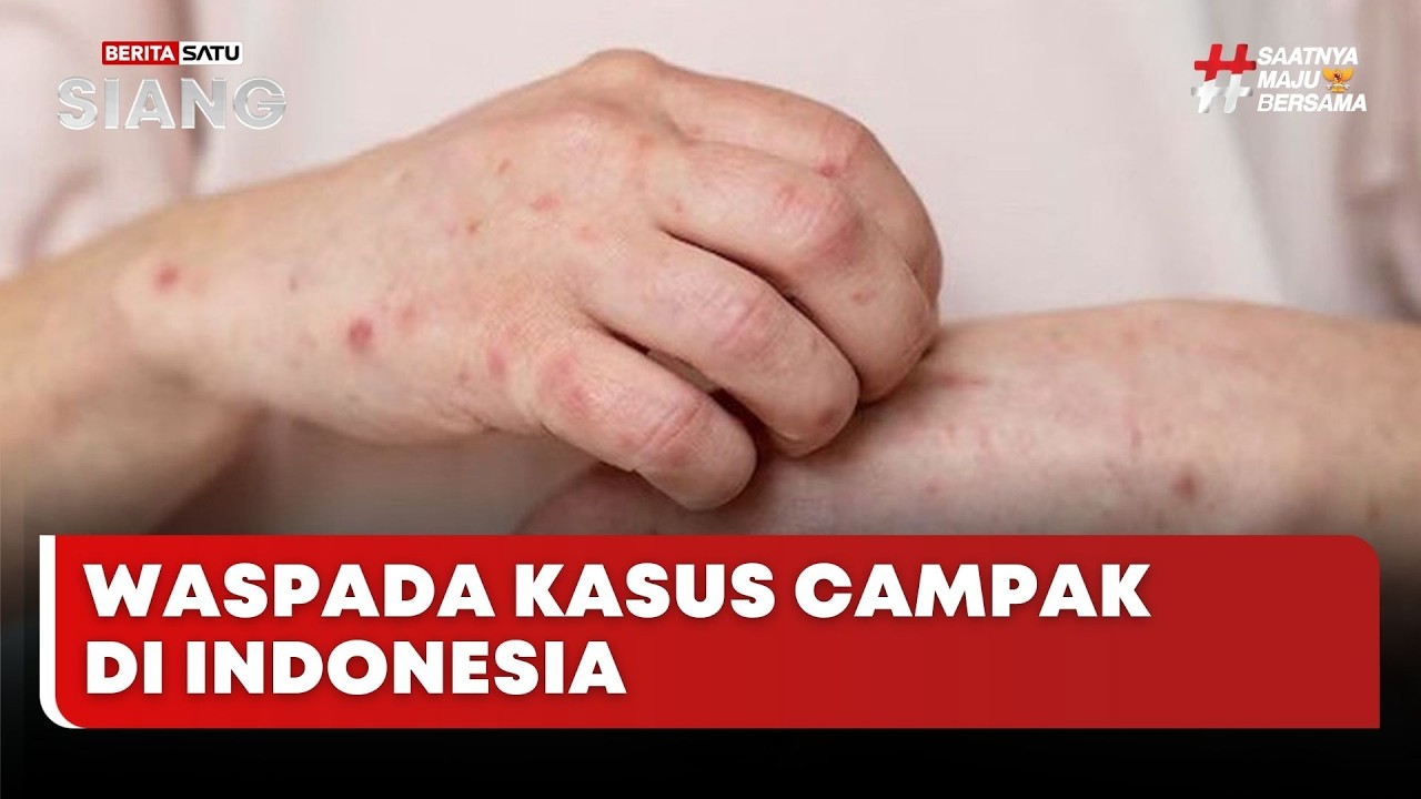 🔴 LIVE | Waspada Kasus Campak di Indonesia - Beritasatu Siang