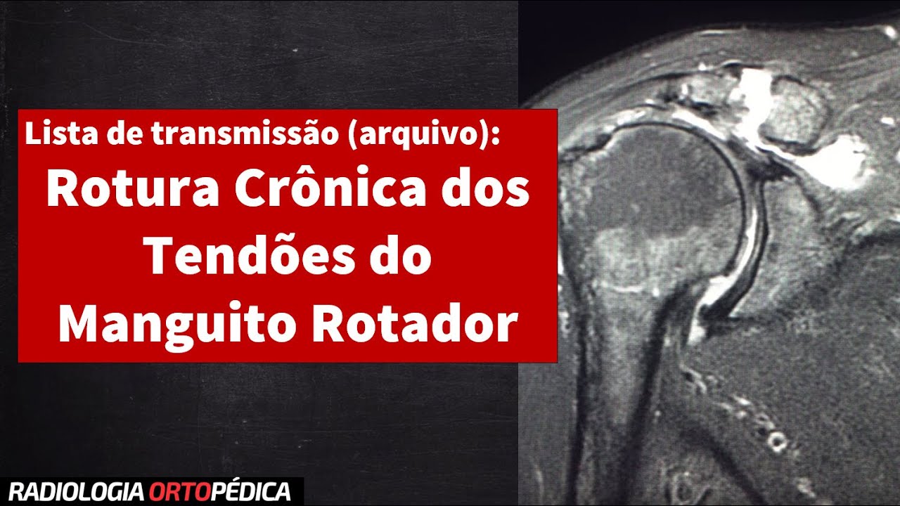Rotura Crônica dos Tendões do Manguito Rotador