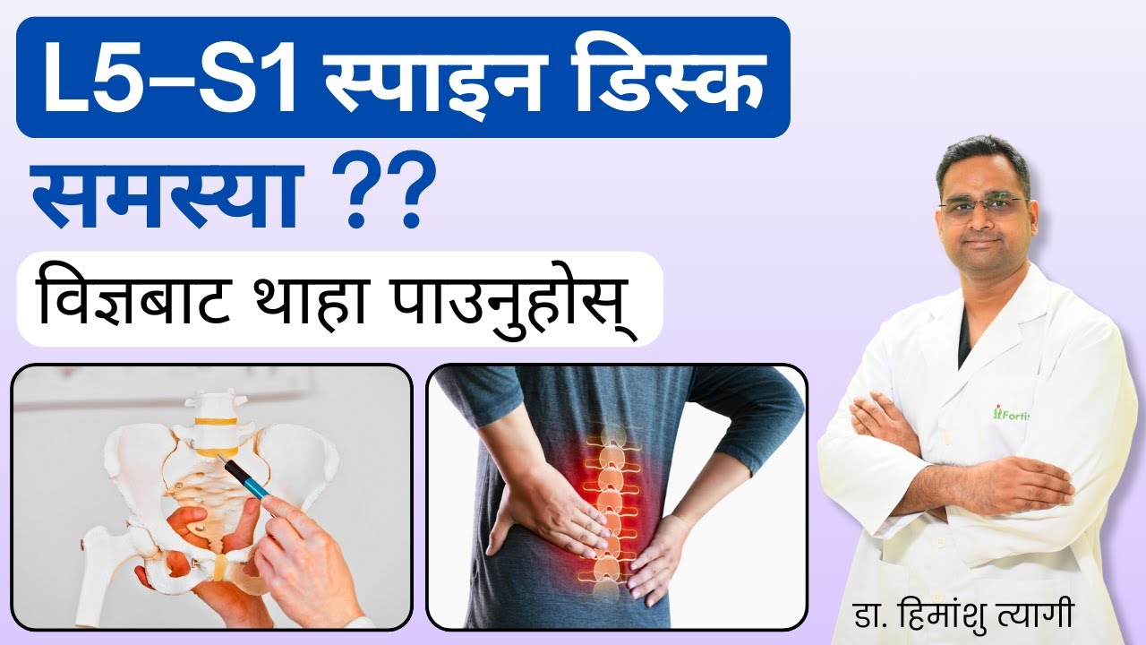 L5–S1 स्पाइन डिस्क समस्या? विज्ञबाट थाहा पाउनुहोस् | L5-S1 Spine Disc problem?? in Nepali