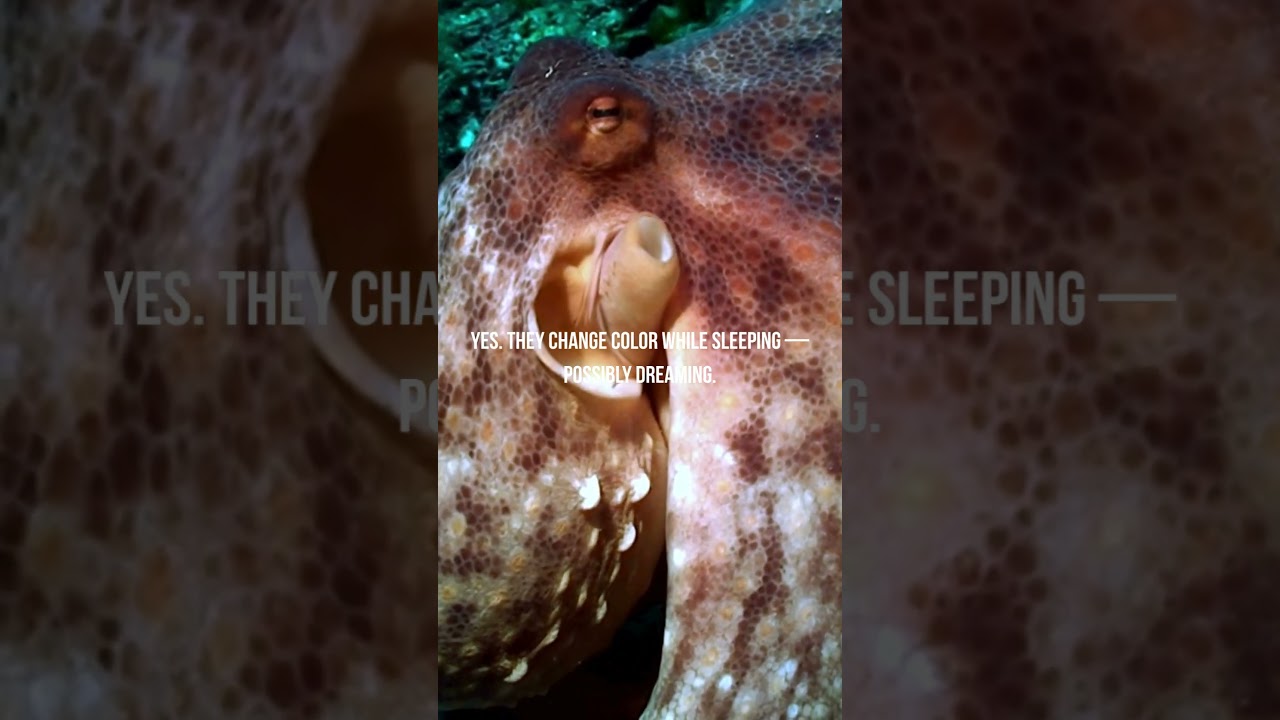 The Octopus Brain is Not Like Ours