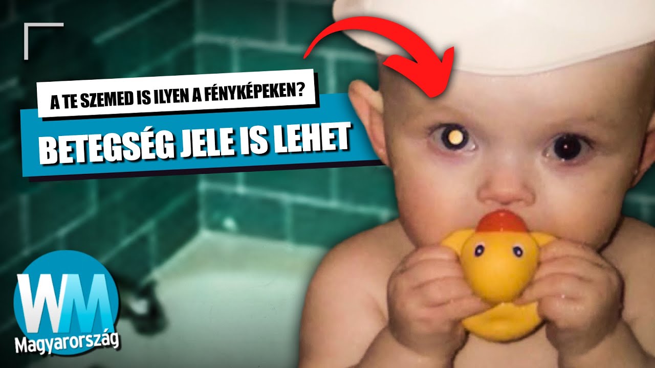 100 hasznos tény és infó, melyek egy nap megmenthetik az életed