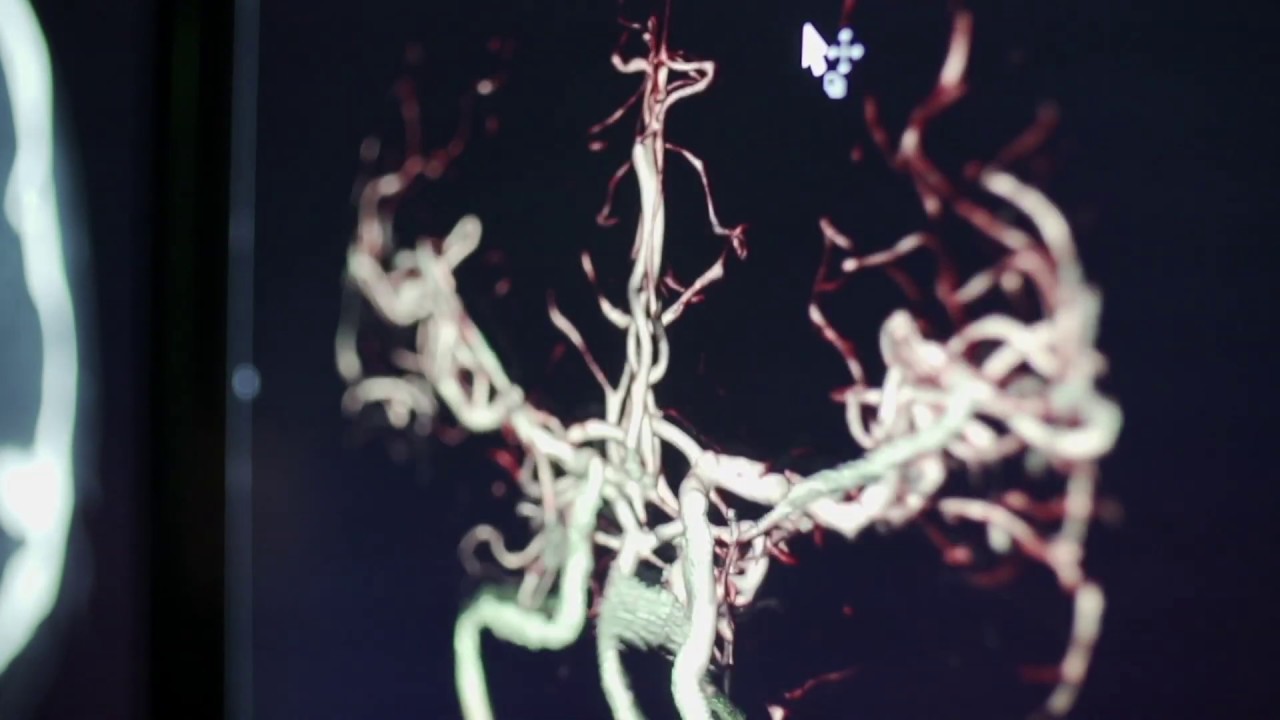 Brain Centre Campaign