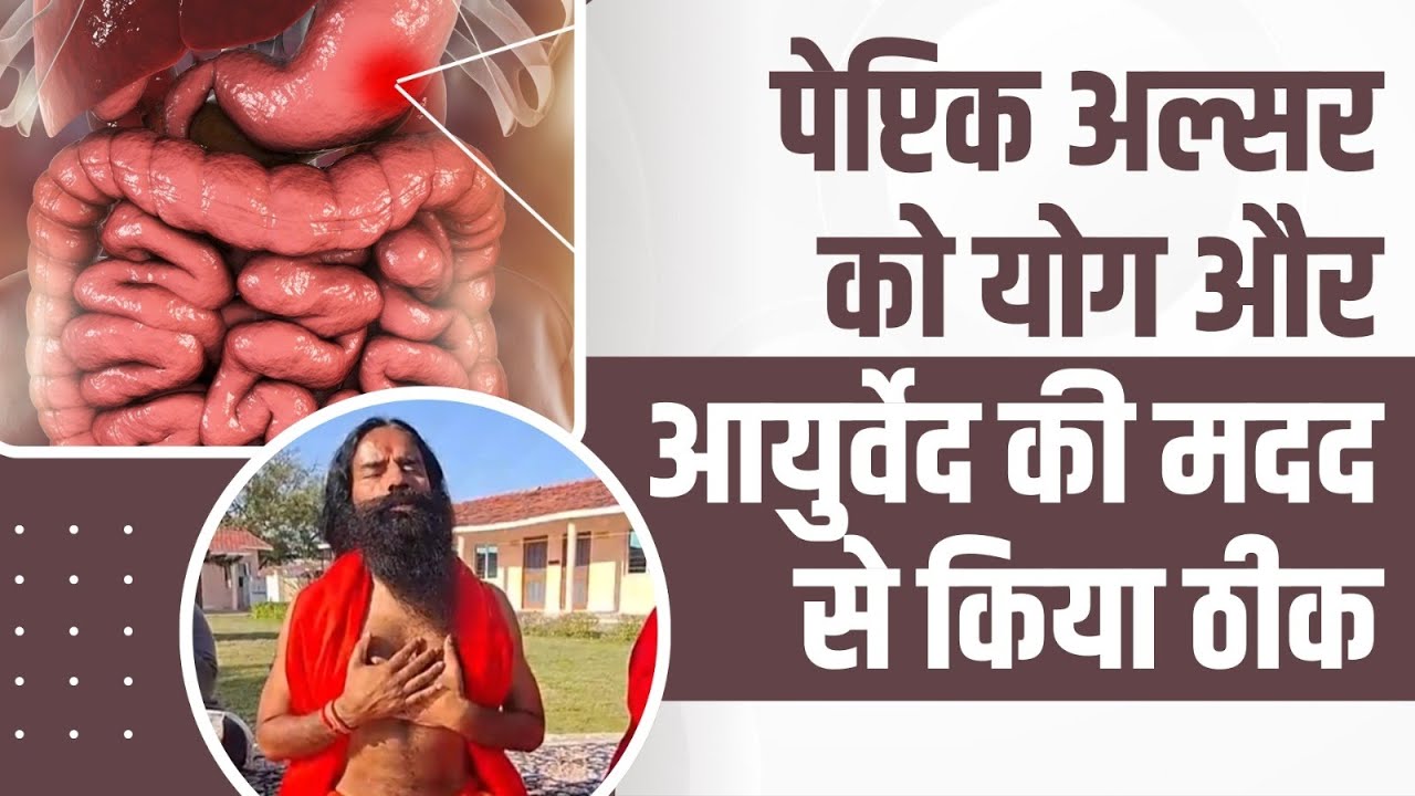 पेप्टिक अल्सर (Peptic Ulcer) को योग और आयुर्वेद की मदद से किया ठीक || Swami Ramdev