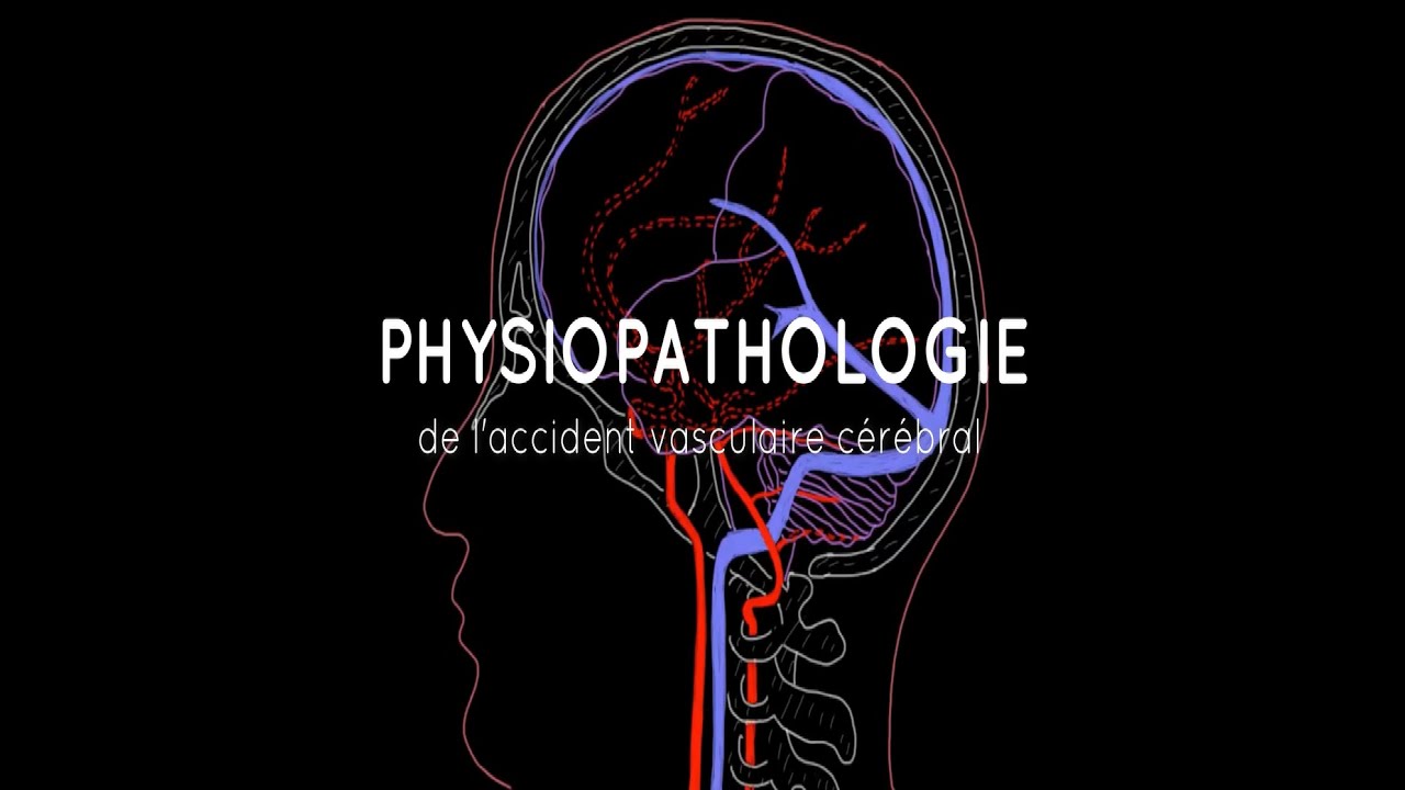 Physiopathologie de l'accident vasculaire cérébral