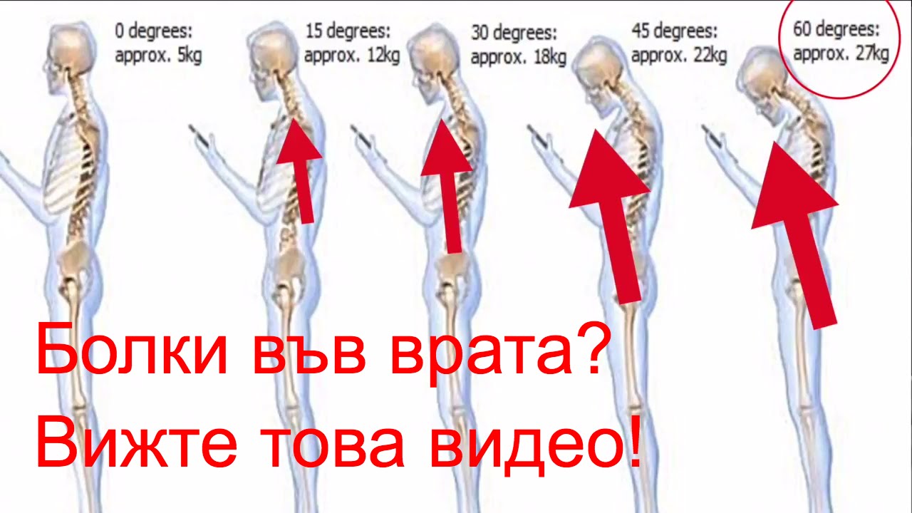 Имате болки в раменете и врата? Вижте това видео! Синдрома на щрауса(глава напред)