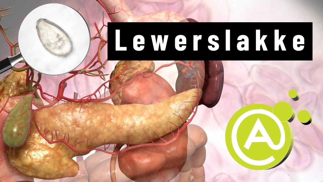 Parasiete: Lewerslakke