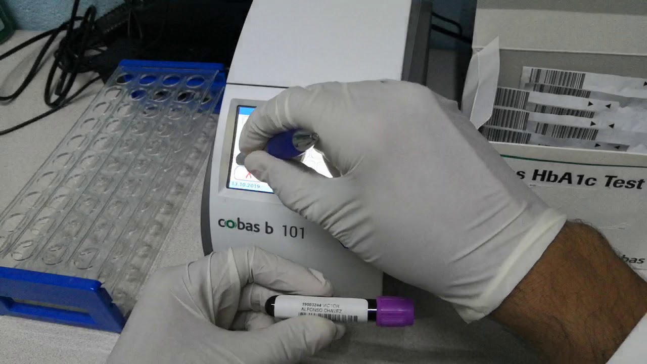 Cobas b 101