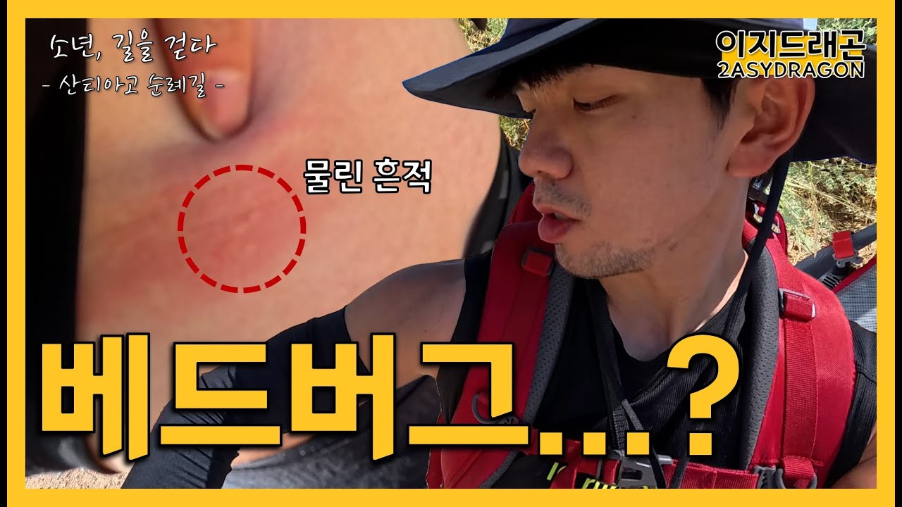 몸에서 험한 것이 나왔다...🪳 | 에스떼야 ~ 산솔 | 산티아고 순례길 EP.8 | 소년, 길을 걷다