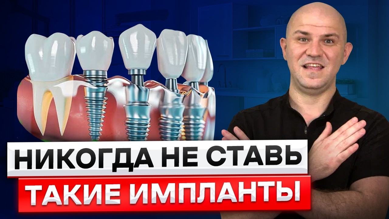 ЗУБНЫЕ ИМПЛАНТЫ. Всё о имплантах в 1 видео. Что выбрать в 2026? Какие зубные импланты лучше?