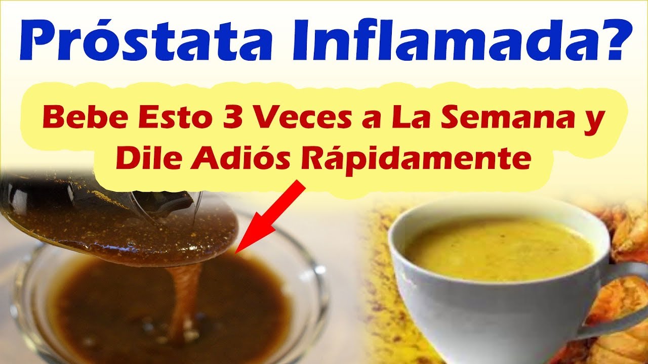 COMO DESINFLAMAR LA PR&Oacute;STATA NATURALMENTE Remedios Caseros Para La Pr&oacute;stata Inflamada