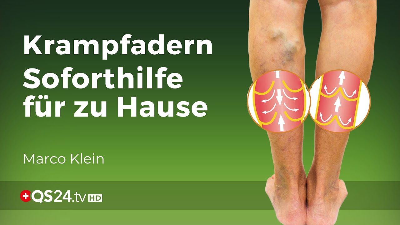 Kleinsche Felder erfolgreich gegen Krampfadern und Besenreiser | NaturMEDIZIN | QS24