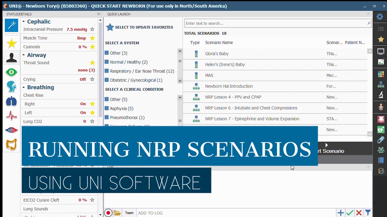 NRP Scenarios in UNI
