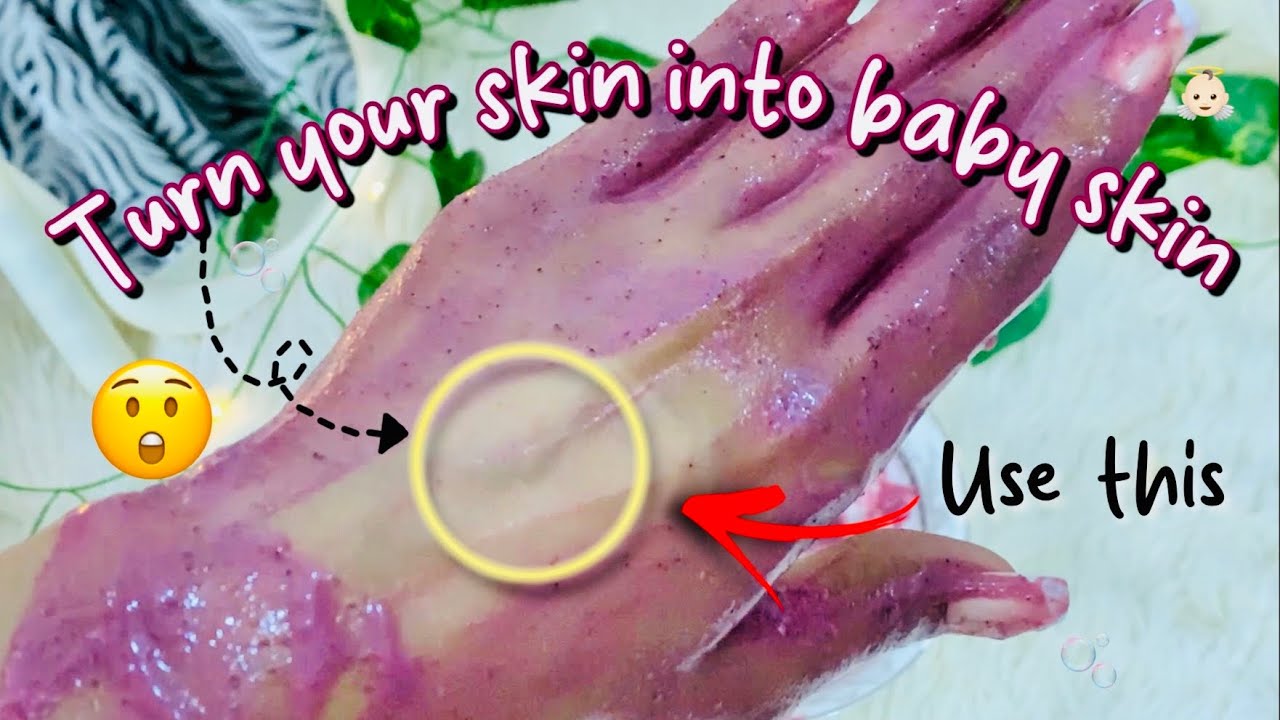The Best DIY Moisturising Cream💗✨ (Day3) Skin Transformation Series ❤️