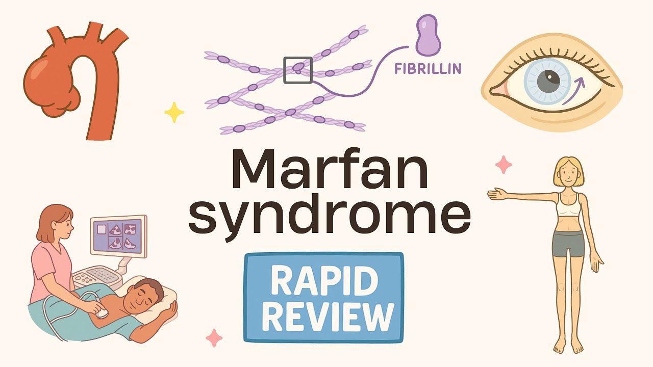 Rapid Review (34/175): Marfan syndrome