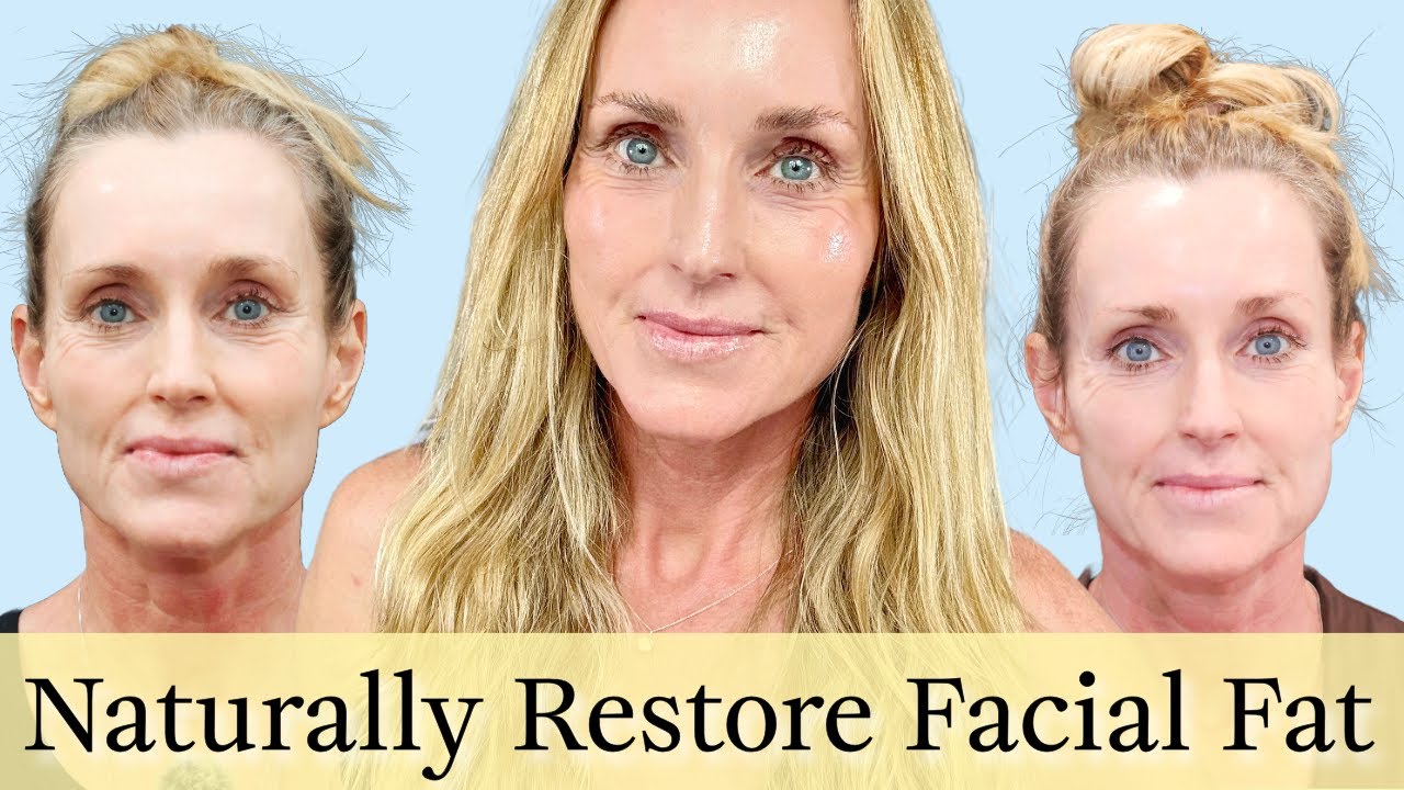 Can you replace Facial Fat/Volume NATURALLY (without Filler?) My 4 months Renuva update