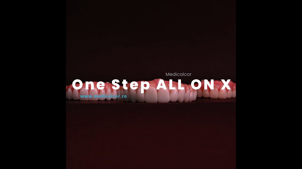 🦷 De ce poți avea &icirc;ncredere &icirc;n One Step All-on-X&reg; &ndash; z&acirc;mbet complet &icirc;n doar 5 zile?
