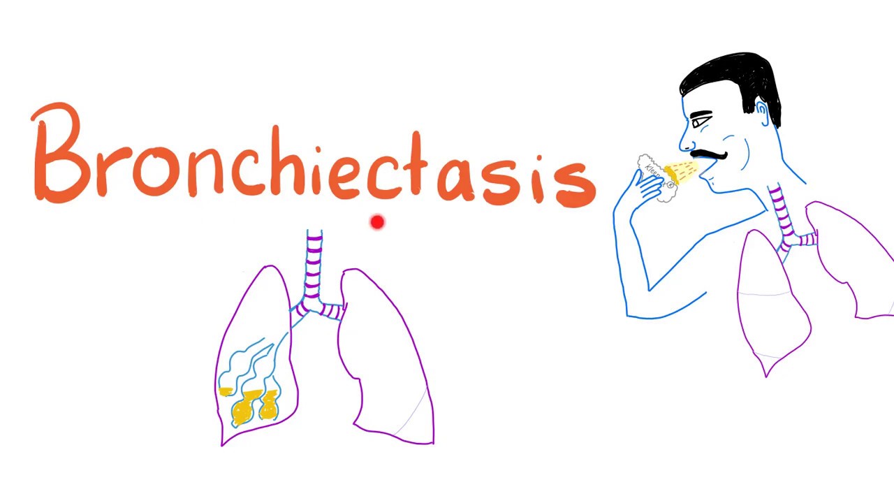 Bronchiectasis - Lung Diseases - Pulmonology Playlist