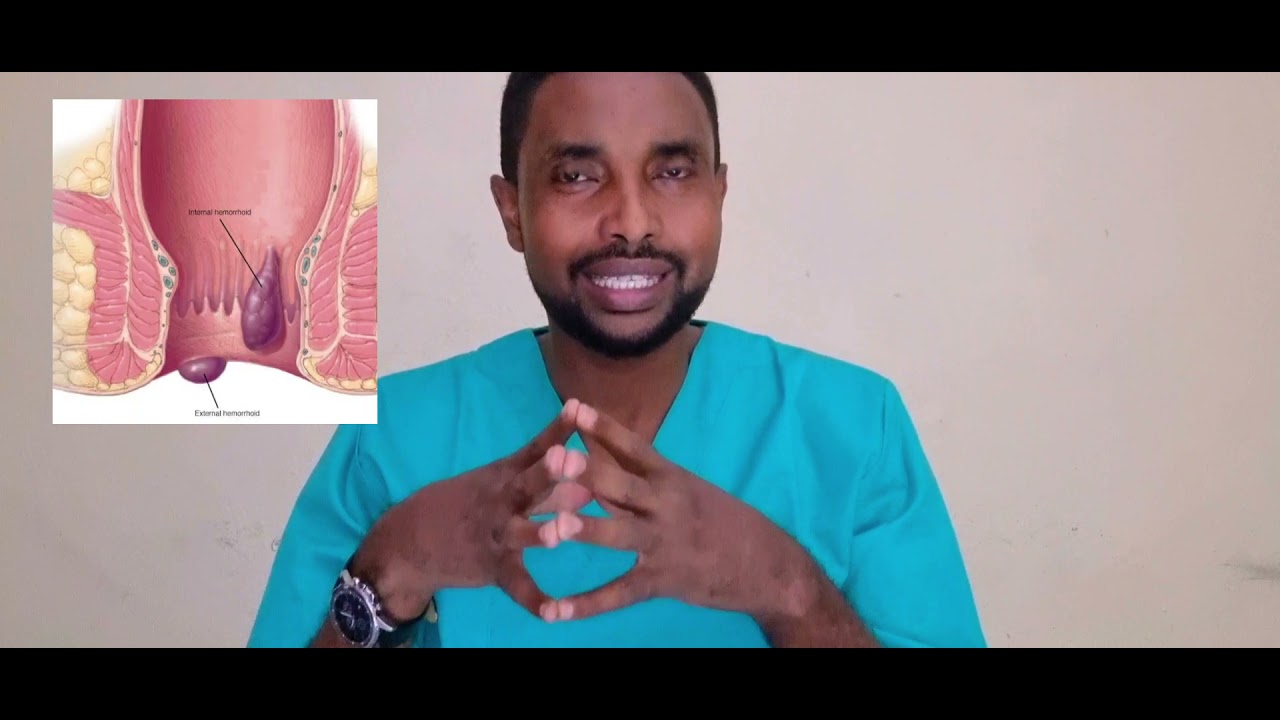Maxaa keena baabasiirka, Cunnooyinka u fiican baabasiirka  Dr Cadceed