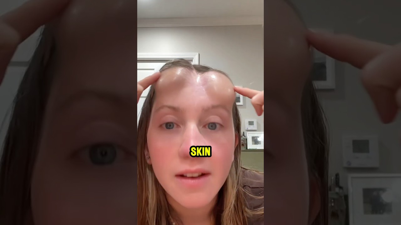 Why Did Her Head Start Growing Bumps?😱