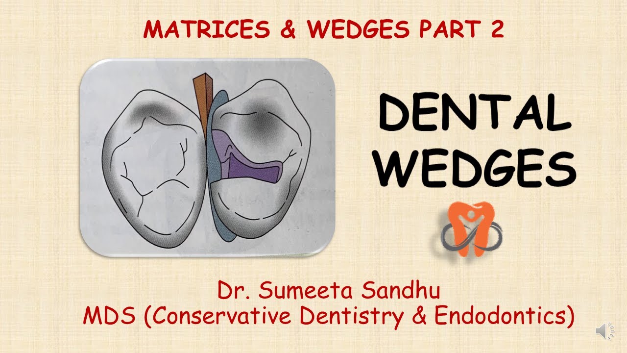Dental Wedges| Matrices & wedges Part 2| Wedge placement |Short notes & viva questions