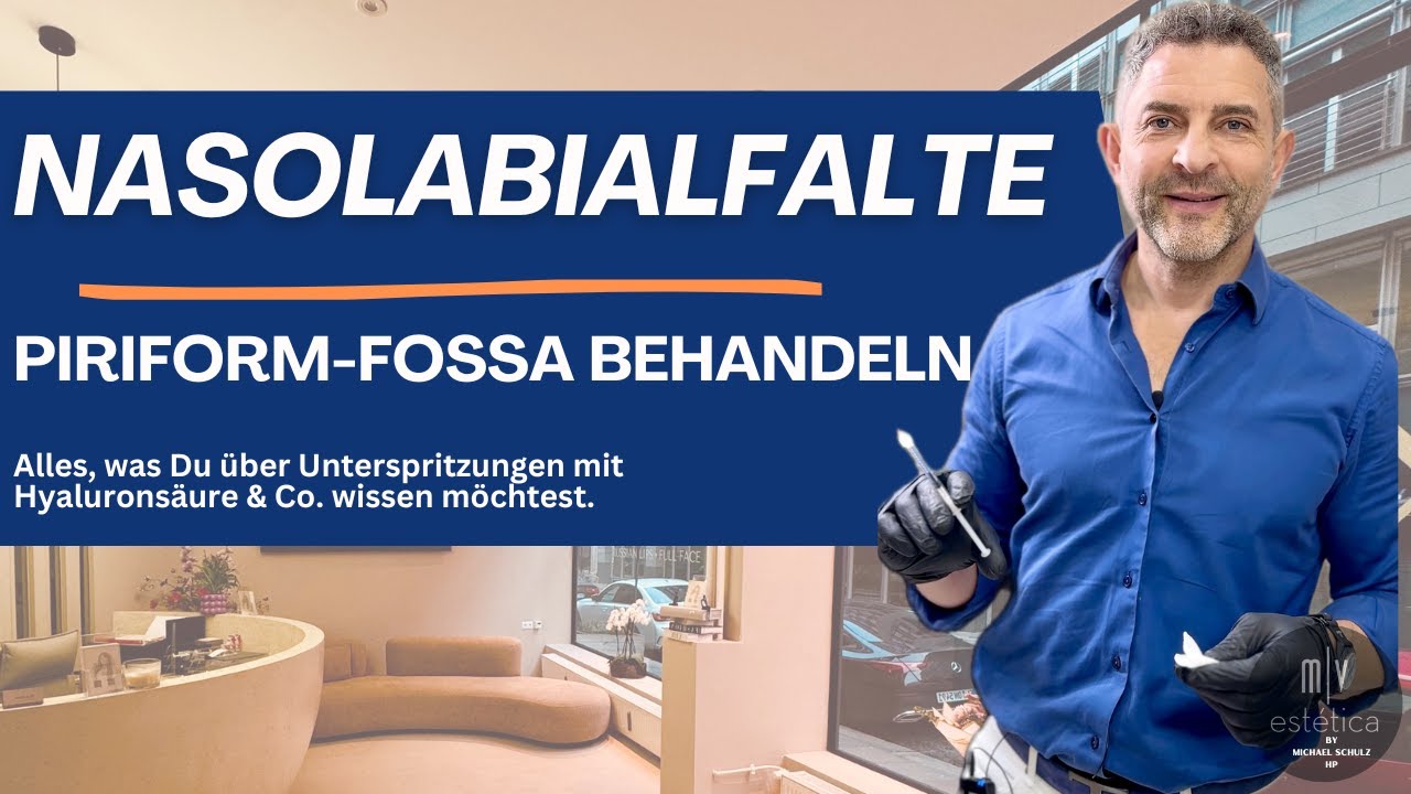 Nasolabialfalte bzw. Piriform-Fossa mit Hyaluronsäure behandeln.