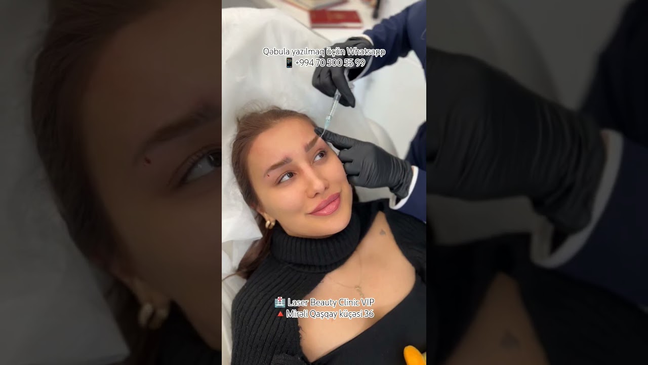 Gözəl pasiyentimiz bloger😍♥️ #botox #beauty #bynikol #nikol