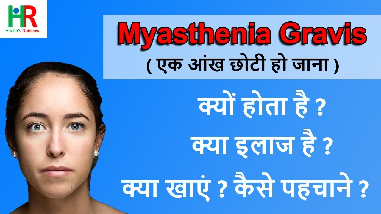 Myasthenia Gravis in hindi | Myasthenia gravis treatment in hindi | myasthenia gravis causes