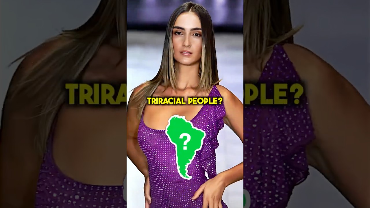 They Are A Mix Of Three Different Races