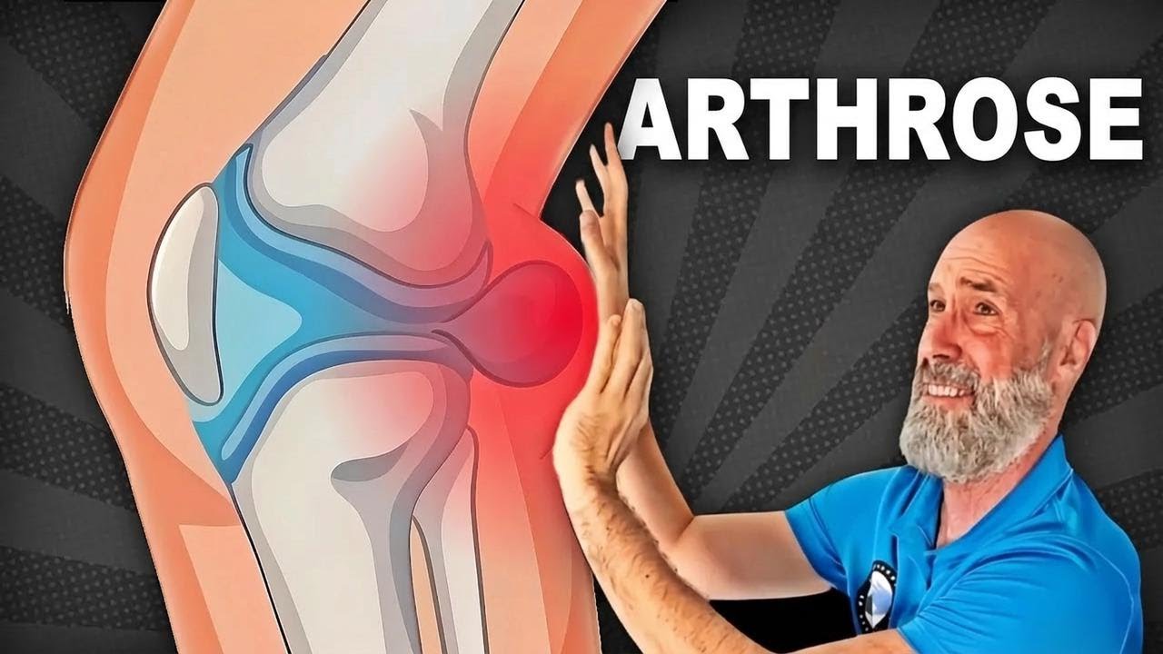 Le secret pour faire disparaître le kyste de Baker sans chirurgie (3 exercices essentiels)