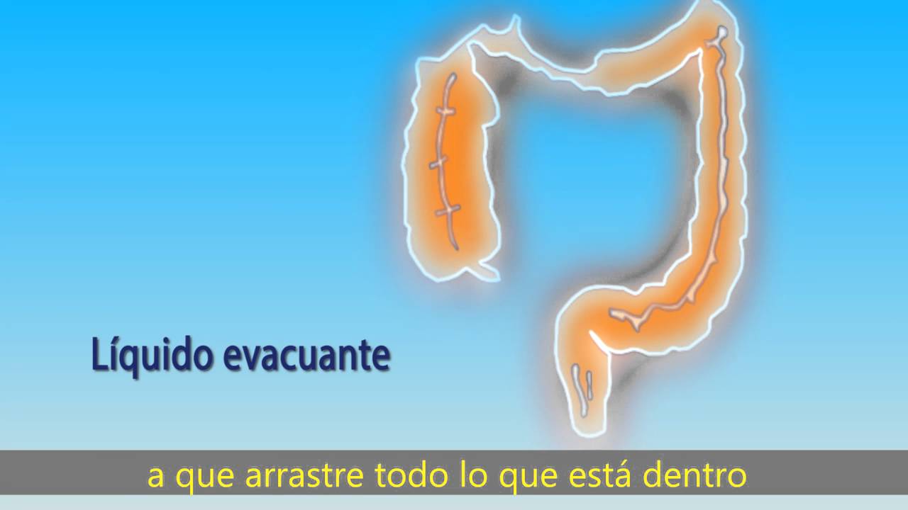 Preparación para una colonoscopia