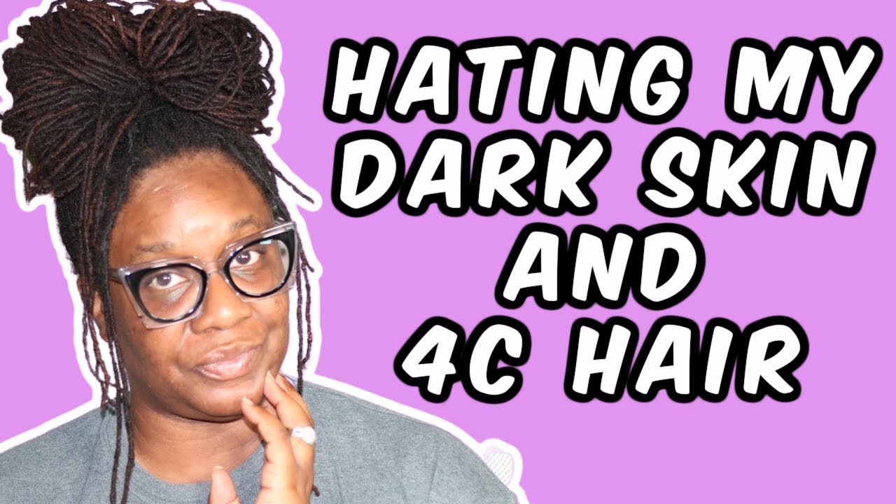 Being Ugly | Part 3 | Hating My Dark Skin and 4C Hair