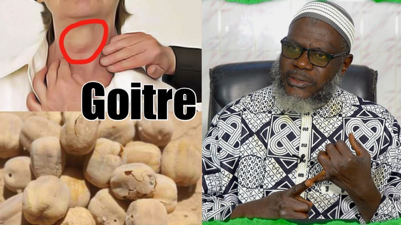 Secret bi neek si soumpou ( GOITRE )  || Oustaz Oumar Ahmad Sall H.A ||