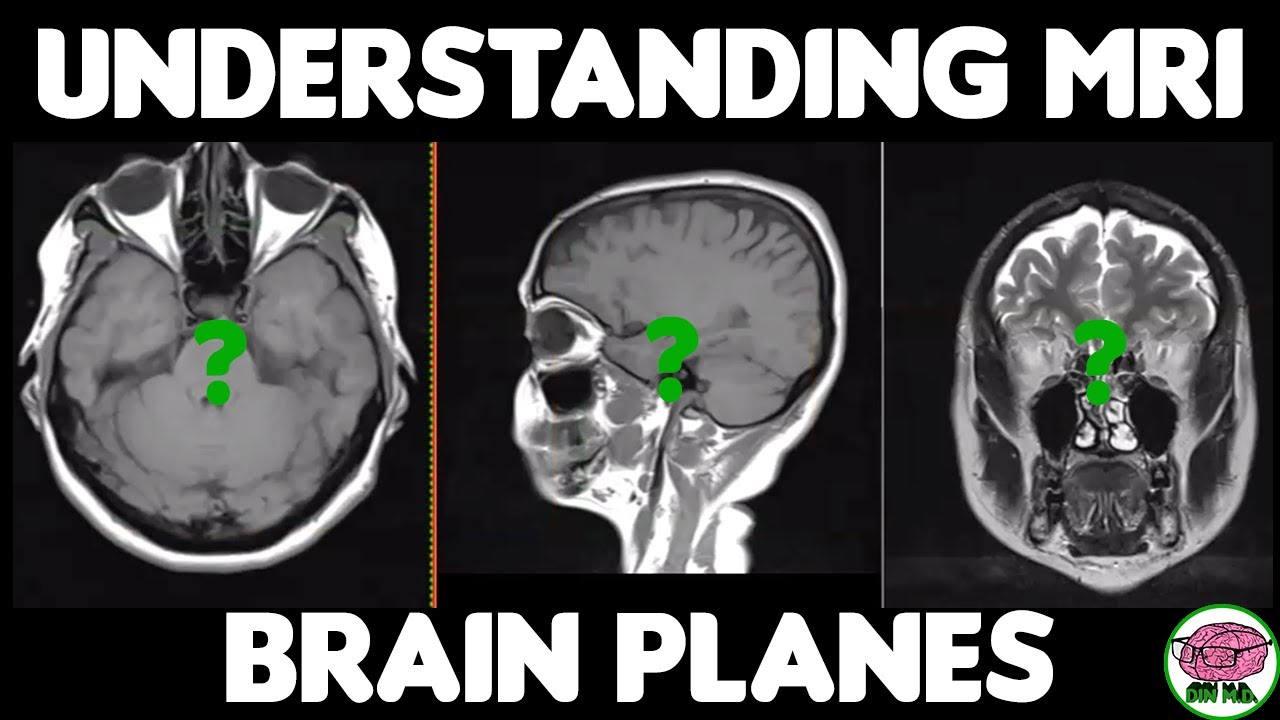 Understanding Brain MRI Planes and Cuts - Magnetic Resonance Imaging 101