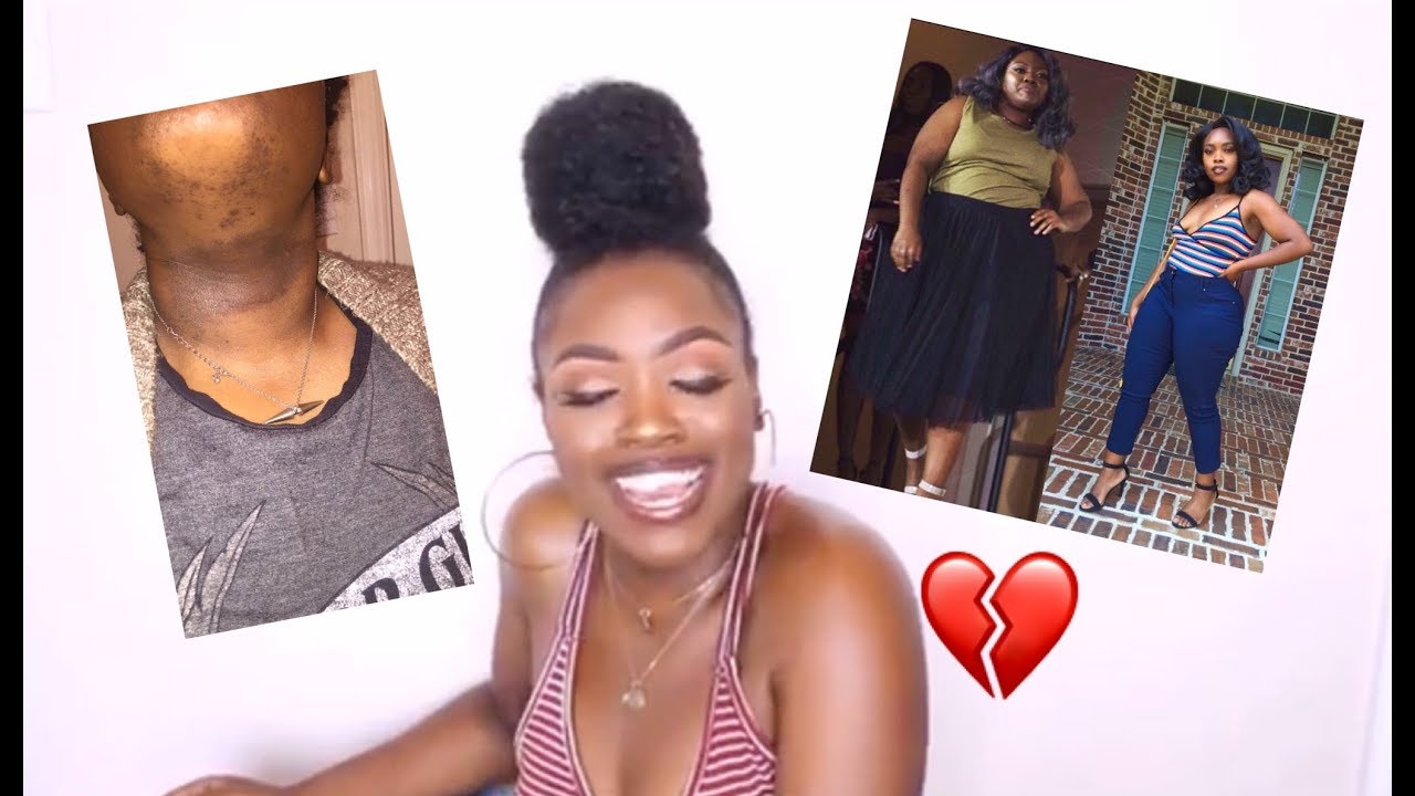 THE REAL REASON I LOST WEIGHT | SUICIDE, DEPRESSION, HEALTH ISSUES, F-BOYS