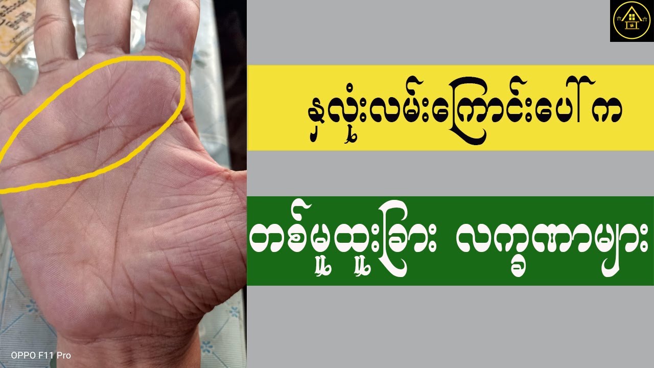 နှလုံးလမ်းကြောင်းပေါ်က တစ်မူထူးခြား လက္ခဏာများအကြောင်း